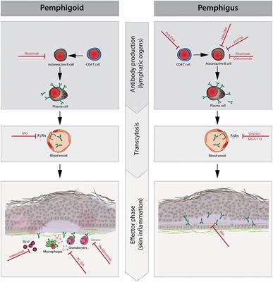 Current Clinical Trials in Pemphigus and Pemphigoid